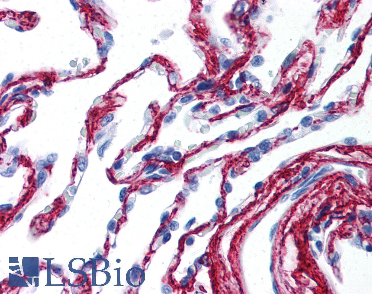 IHC-plus™ Collagen VI Antibody