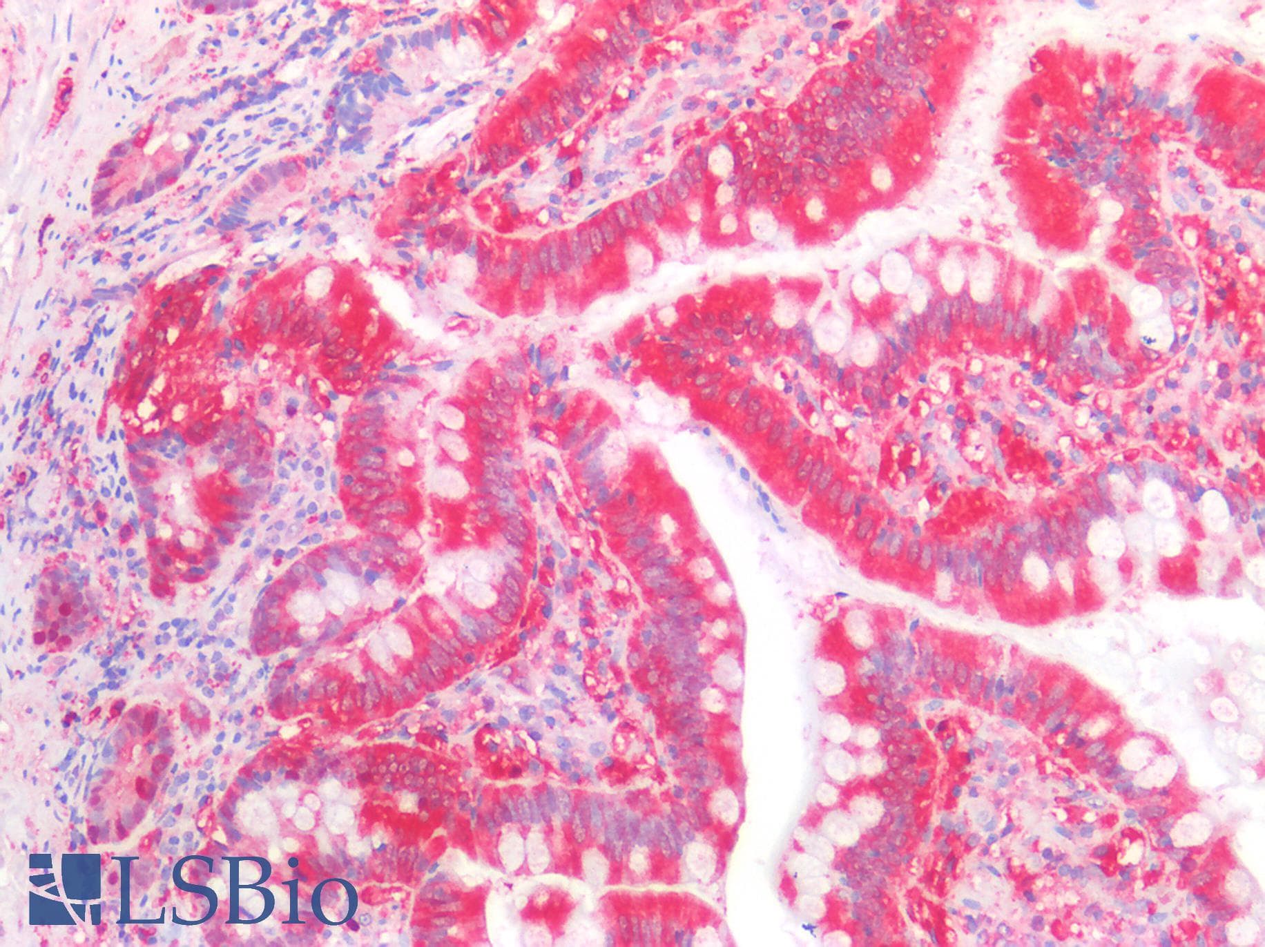 PathPlus™ ALDH1A1 / ALDH1 Antibody