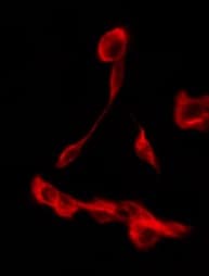 Polyclonal Rabbit anti-Human SLC9A3R2 / SIP1 Antibody (IF, WB)