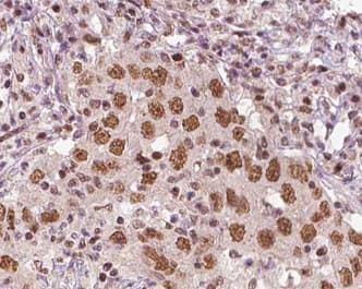 XRN2 Antibody