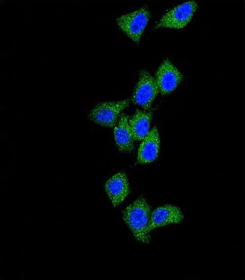 CASP8 / Caspase 8 Antibody (aa432-461)
