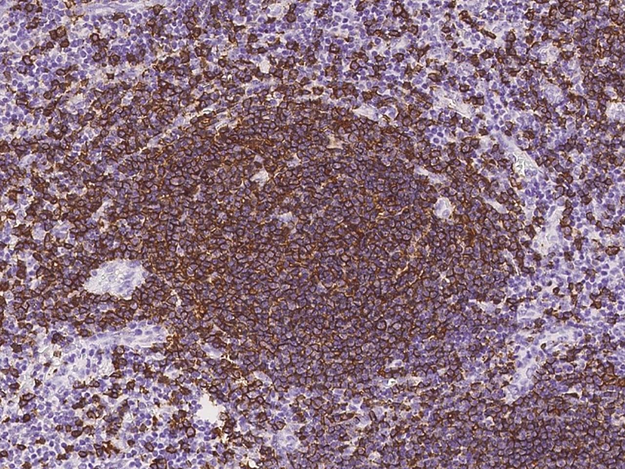 Polyclonal Rabbit anti-Human CD20 Antibody (IHC, IF)