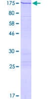 Human VARS / ValRS Protein (Recombinant GST)