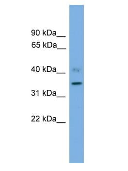 Polyclonal Rabbit anti-Human SLC25A48 Antibody (aa241-290, WB)