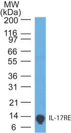 IL17RE Antibody (clone 46N7E3)