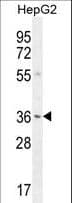 VSIG1 Antibody (aa293-322)