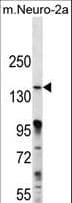 MAP3K15 / ASK3 Antibody (aa315-342)