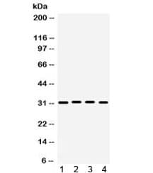 Polyclonal Rabbit anti-Human KCNIP2 / KCHIP2 Antibody (IHC, WB)