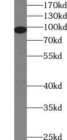 TLR2 Antibody
