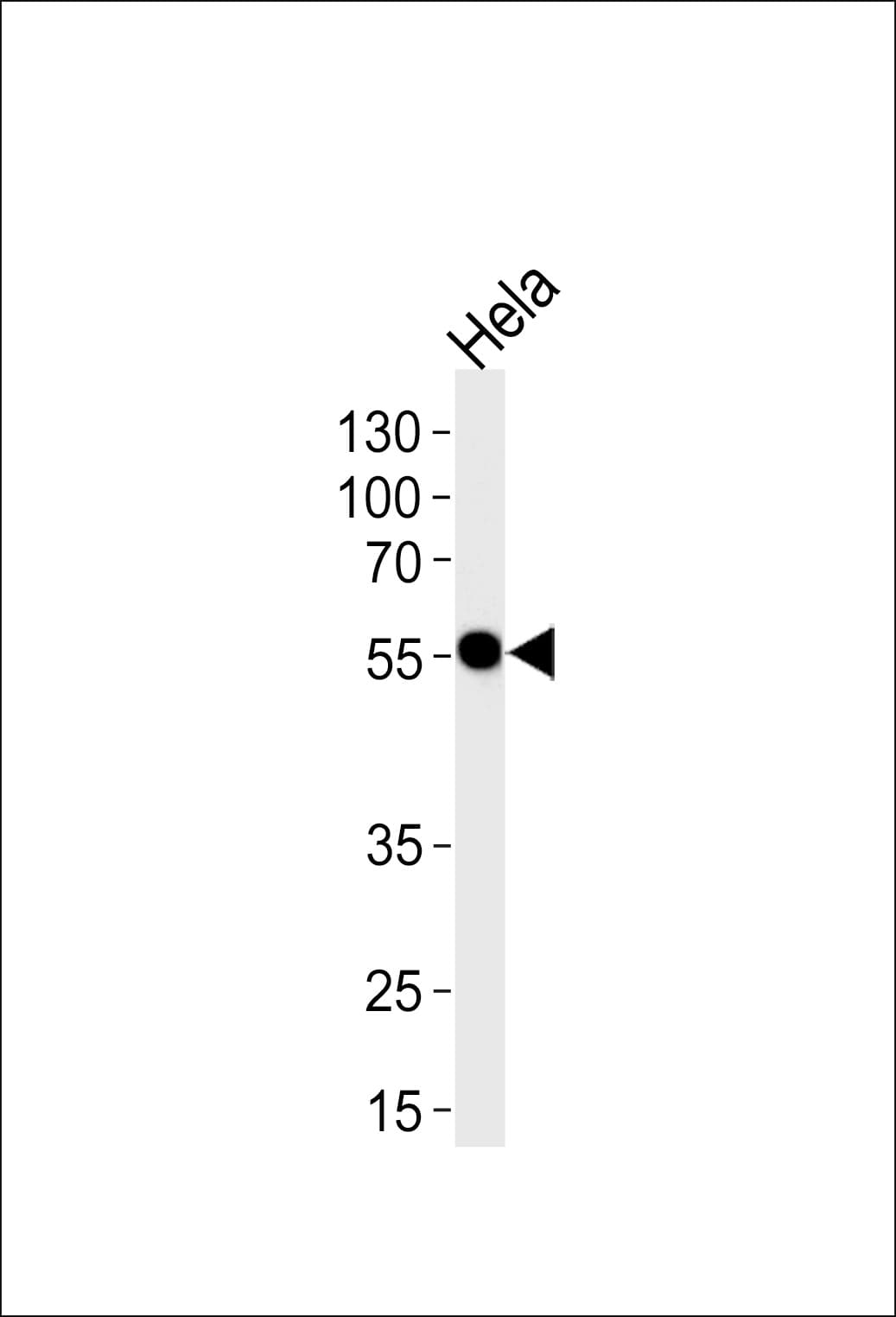 DDX6 Antibody (aa455-483)