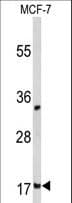 Polyclonal Rabbit anti-Human DSTN / Destrin Antibody (aa70-98, IHC, WB)
