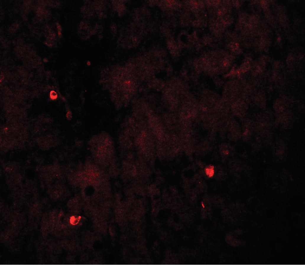 IHC-plus™ TRIM33 / TIF1-Gamma Antibody