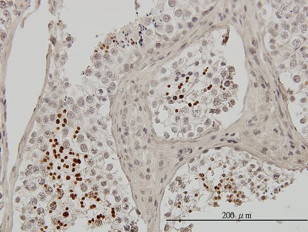 TNP1 / TP1 Antibody (clone 1B5)