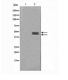 ERK1 + ERK2 Antibody (phospho-Tyr204)