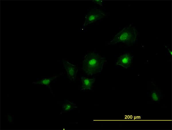 Monoclonal Mouse anti-Human RBM39 Antibody (clone 4G8, IHC, IF, WB)