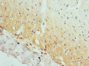 AP2A2 Antibody