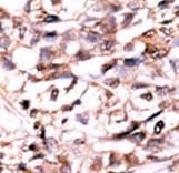 Polyclonal Rabbit anti-Human DUSP13 Antibody (aa1-30, IHC, WB)