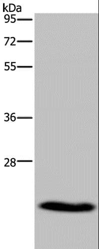CKLFSF5 / CMTM5 Antibody