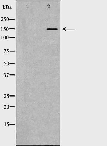 INSR / Insulin Receptor Antibody