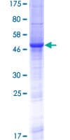 Human RS1 / Retinoschisin 1 Protein (Recombinant GST)