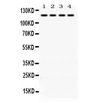 OGT / O-GLCNAC Antibody (aa1008-1046)