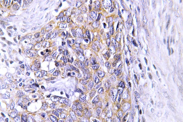 CLN6 Antibody (Asn258)