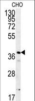 Polyclonal Rabbit anti-Human ERI3 Antibody (aa309-337, IHC, WB)