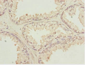 KPNA6 Antibody