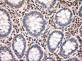 TRIM33 / TIF1-Gamma Antibody (clone OTI9D4)
