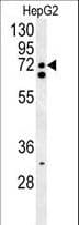 Polyclonal Rabbit anti-Human CLASRP Antibody (aa254-283, WB)