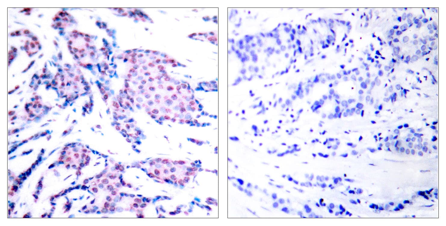 JUN / c-Jun Antibody (phospho-Thr93)