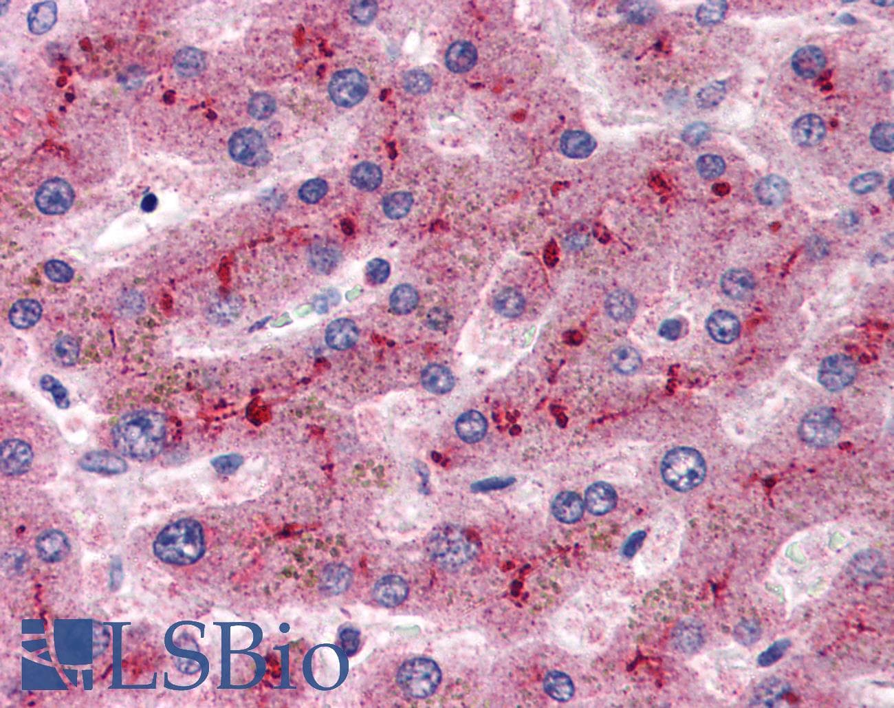 IHC-plus™ Polyclonal Goat anti-Human CFH / Complement Factor H Antibody (aa577-588, IHC, WB)