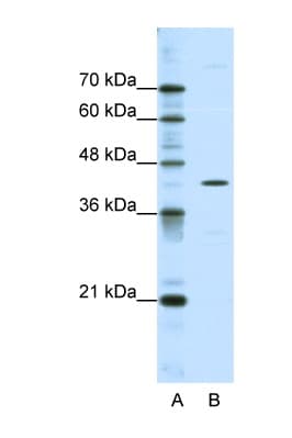 DOK2 Antibody (C-Terminus)