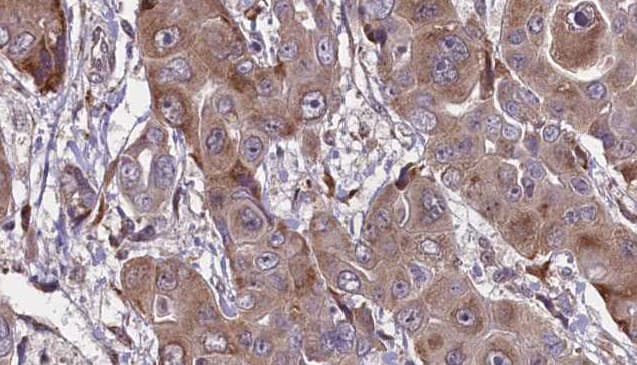 FCGR1A / CD64 Antibody