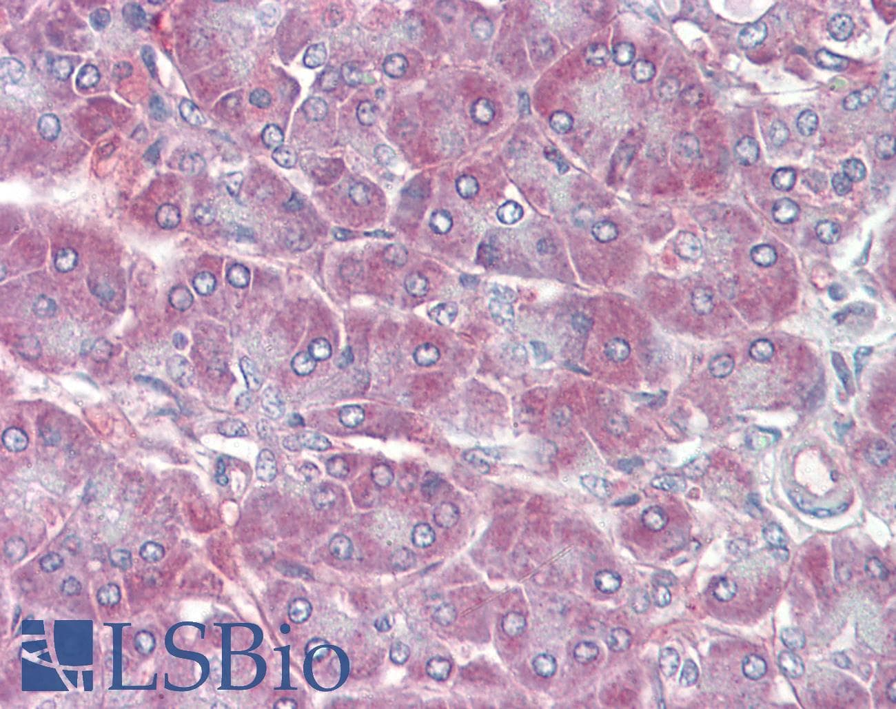 IHC-plus™ RBP1 / CRBP Antibody (aa122-135)