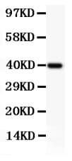 PRF1 / Perforin Antibody (aa175-555)