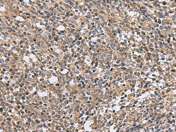 KIAA1970 / EARS2 Antibody