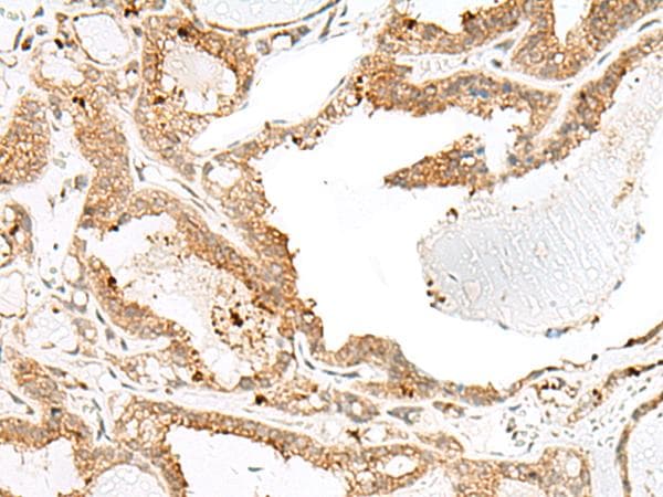 ENAH / MENA Antibody