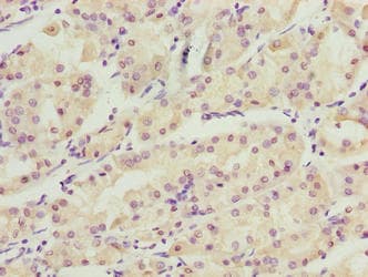 WDR34 Antibody