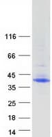 Human MFAP4 Protein (Recombinant Myc-DDK (Flag))
