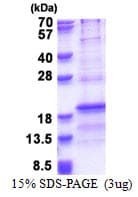 Human RPL31 / Ribosomal Protein L31 (Recombinant His)