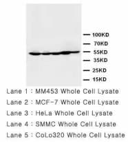 HDAC2 Antibody (aa464-478)