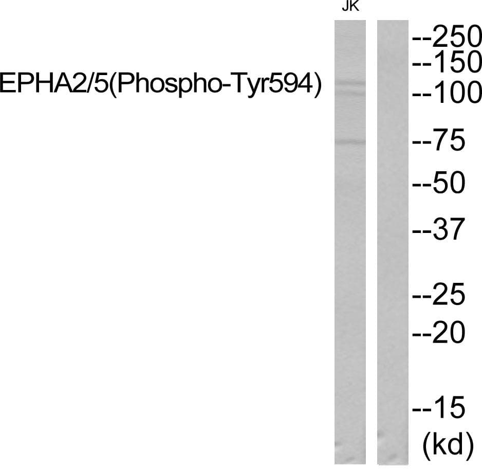 EPHA2 + EPHA5 Antibody (phospho-Tyr594)