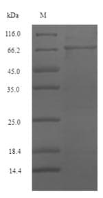 Mouse SRF / Serum Response Factor Protein (Recombinant 6His-SUMO, N-terminus)