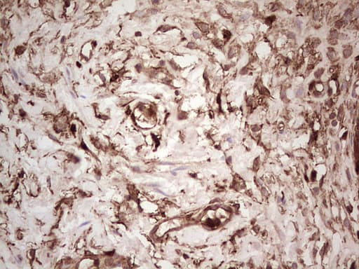 LGALS9 / Galectin 9 Antibody (clone OTI1D12)