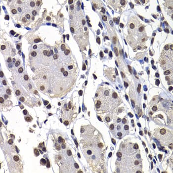 H2AFY / MACROH2A1 Antibody