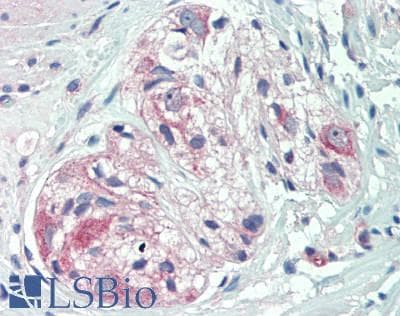 PathPlus™ CSPG4 / NG2 Antibody (aa559-776)