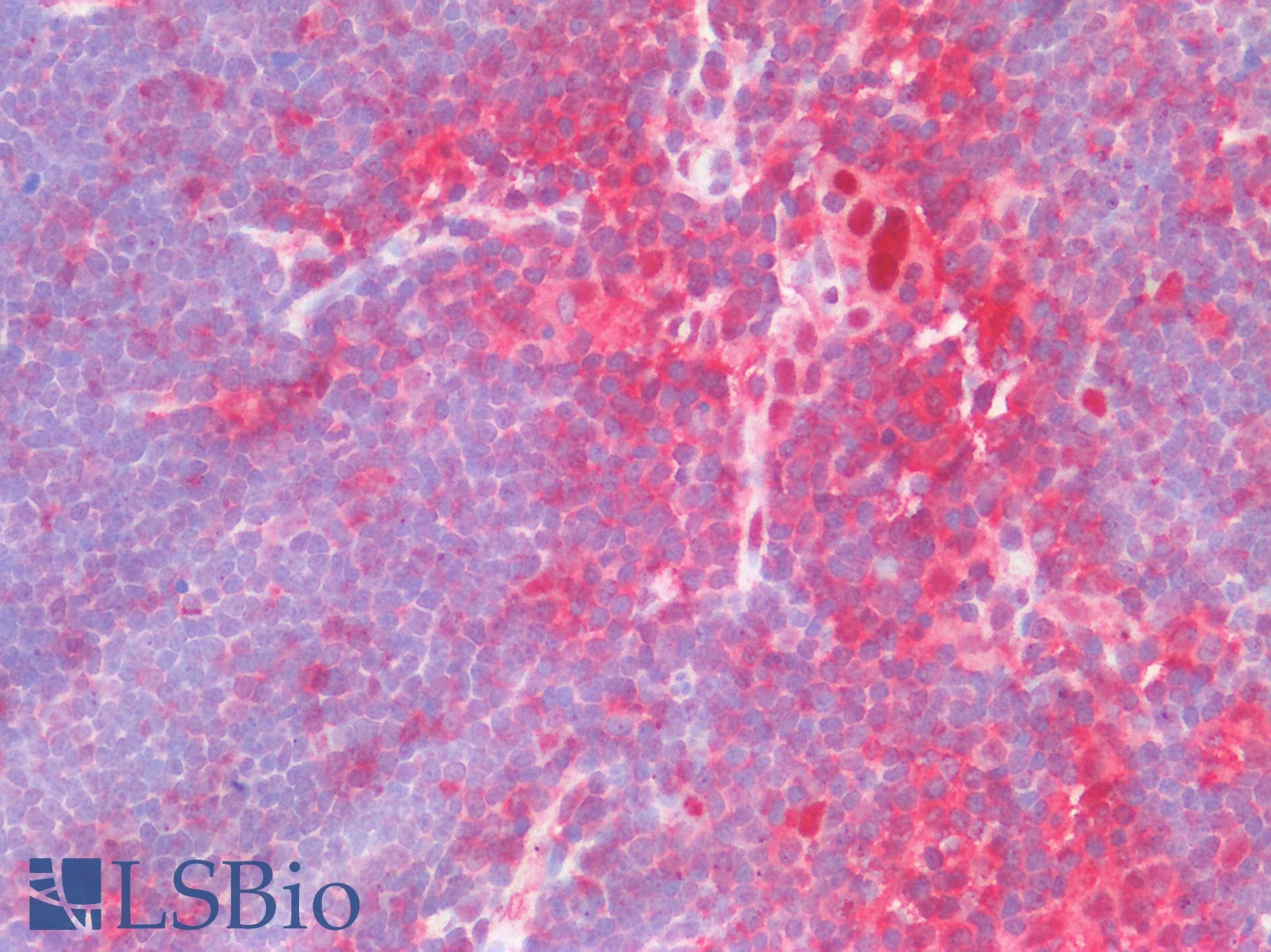 PathPlus™ Polyclonal Rabbit anti-Human SH2D2A Antibody (aa200-249, IHC, WB)