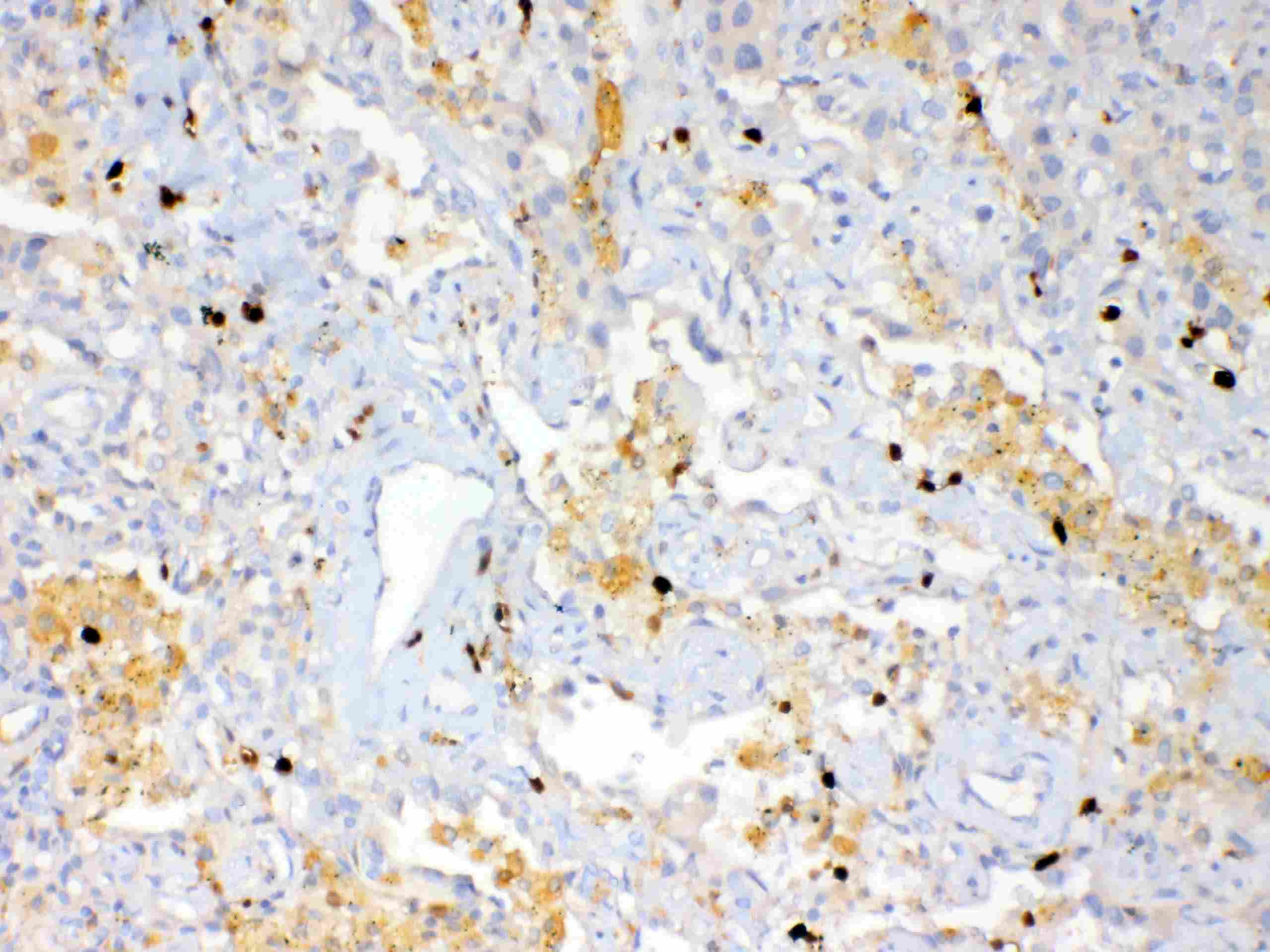 S100A7 / Psoriasin Antibody