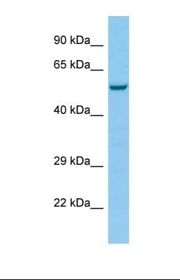HTR3E / 5-HT3E Receptor Antibody (C-Terminus)